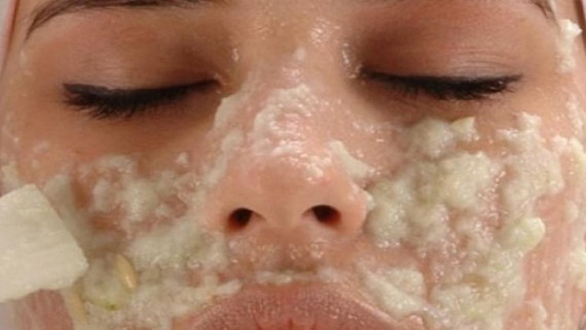 foarte tare si a frecat fata cu cartofi cruzi ce i s a intamplat instant