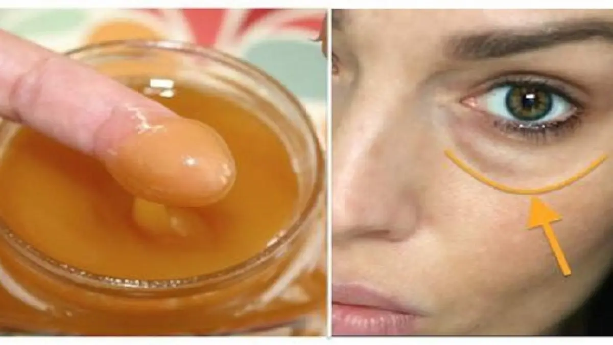 si a aplicat acest amestec sub ochi si s a trezit fara cearcane si pungi cum e posibil metoda care
