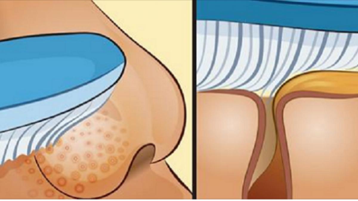 femeia asta si a frecat nasul cu o periuta de dinti pana cand a obtinut acest rezultat uimitor