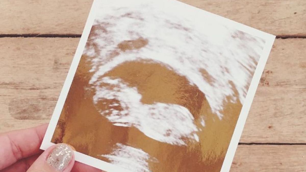 o cunoscuta prezentatoare tv este insarcinata a postat ecografia pe facebook