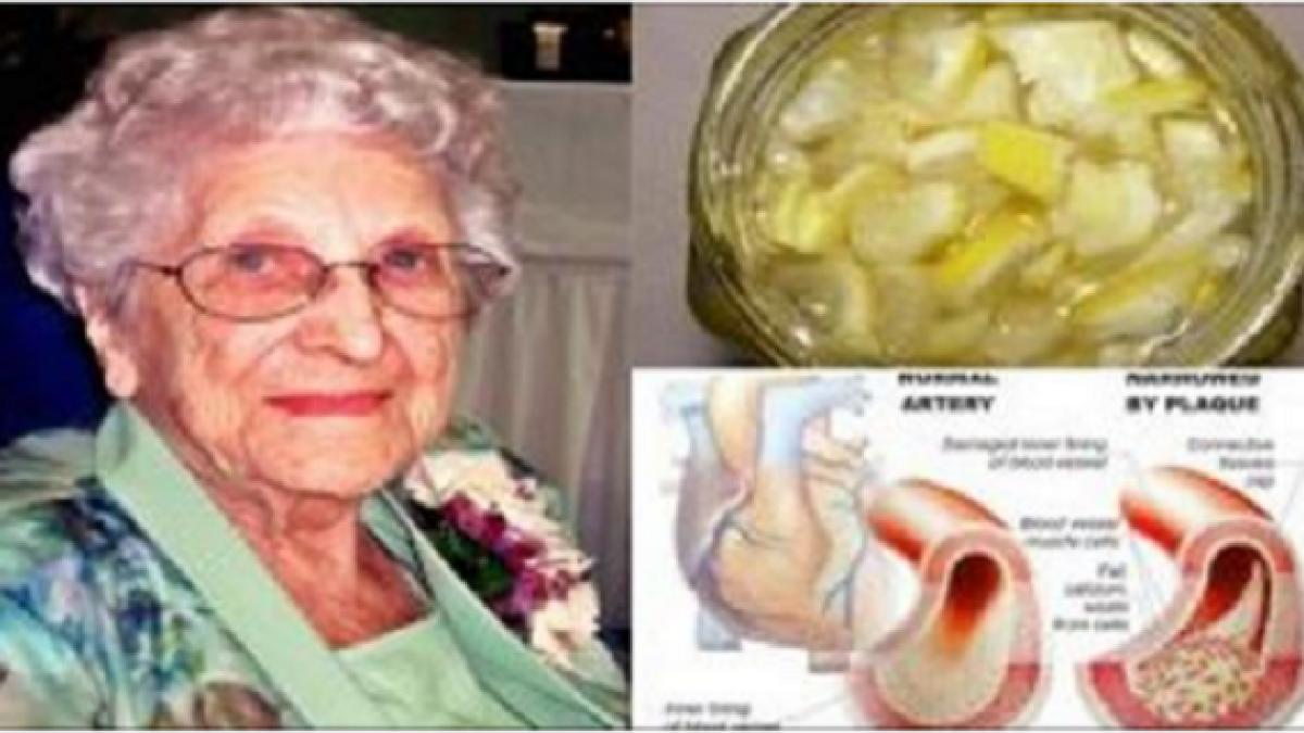 aceasta bunica are 85 de ani si nu a avut niciodata tensiune si colesterol marite uite care este