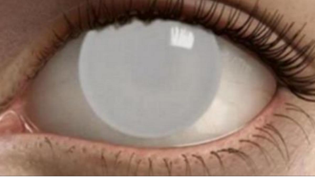 atentie mare acvitatea asta zilnica orbeste mai mult de 30 de persoane pe an