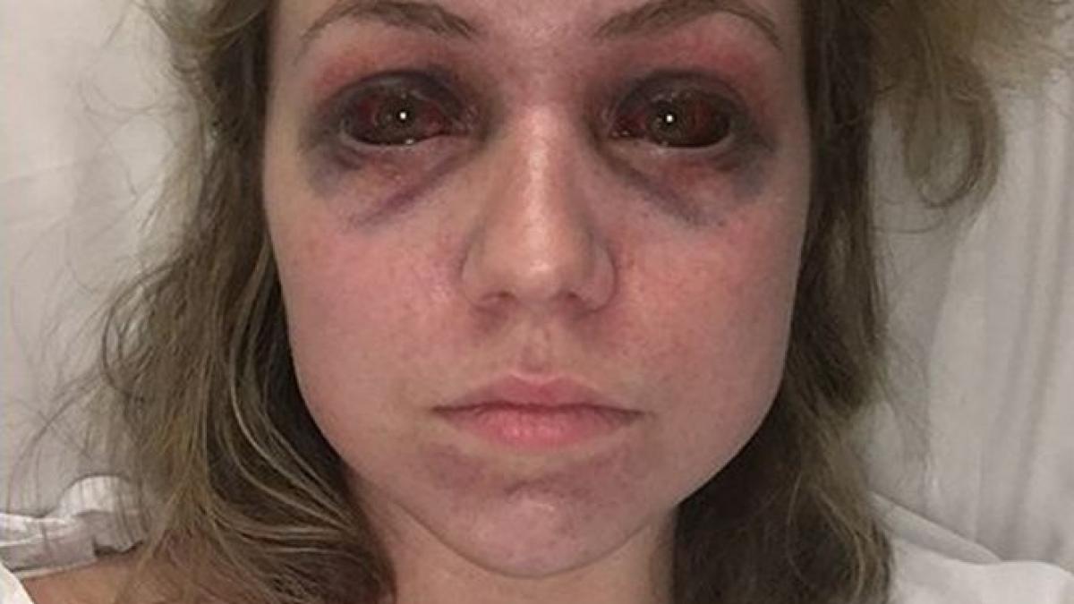 ochii i s au umplut cu sange si nu mai putea sa vorbeasca ce a patit tanara credeam ca o sa mor