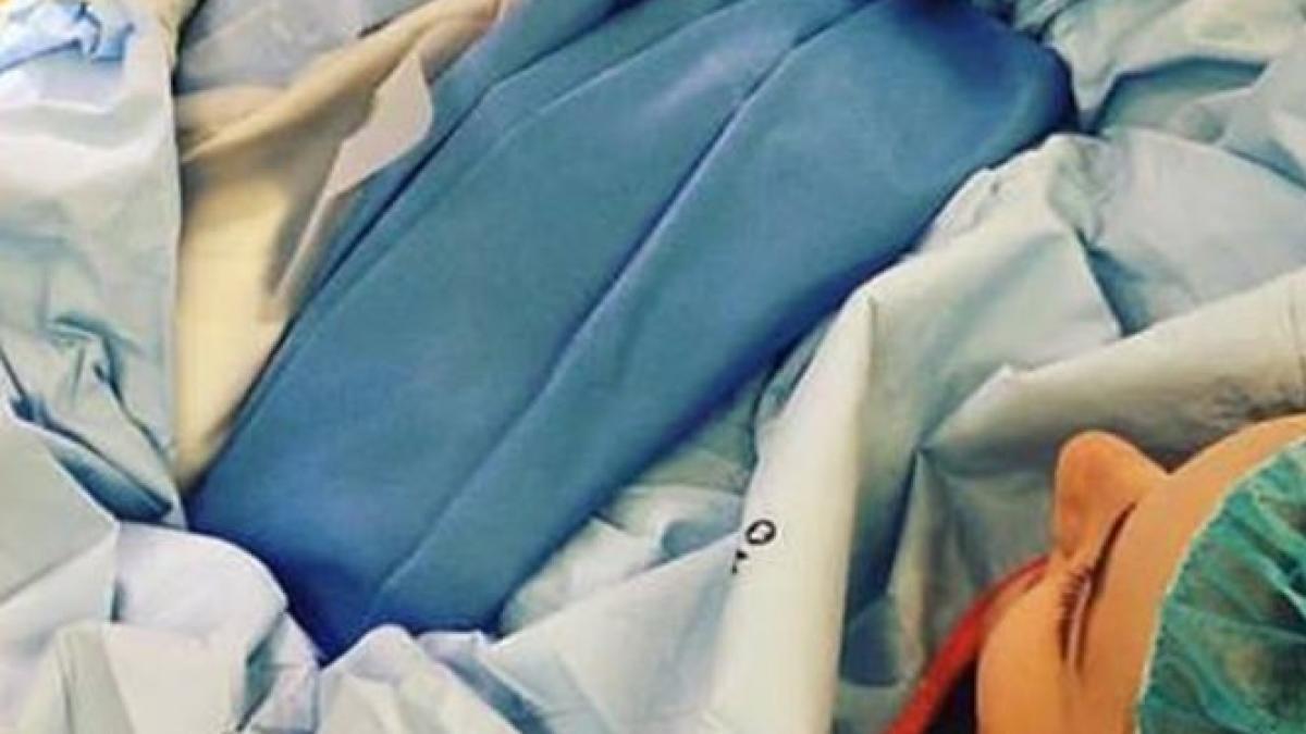 si a scos singura copilul din pantece in timpul unei cezariene