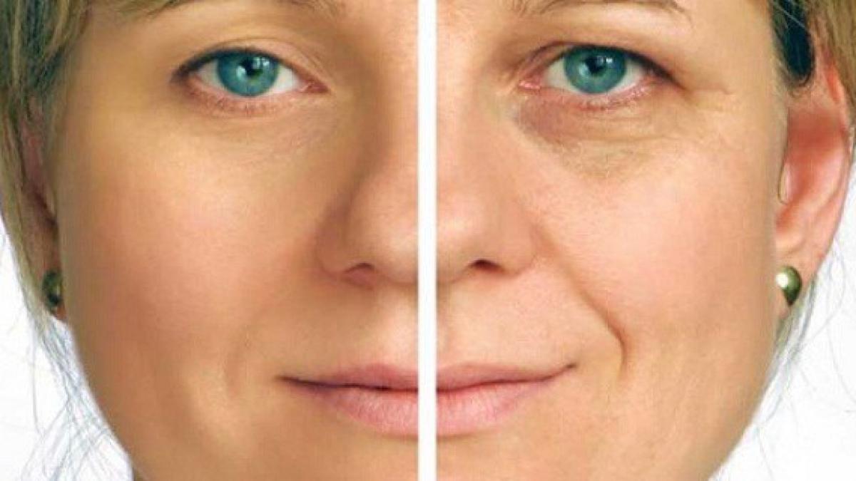 s a spalat pe fata cu acest amestec inainte de culcare si a scapat rapid de riduri si pete