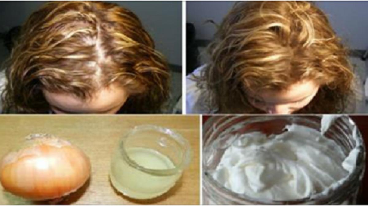 remediul incredibil care iti indeseste parul intr o singura saptamana