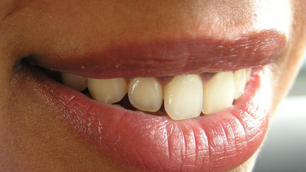 si a clatit gura cu ulei in fiecare seara timp de doua saptamani ce s a intamplat cu dintii ei