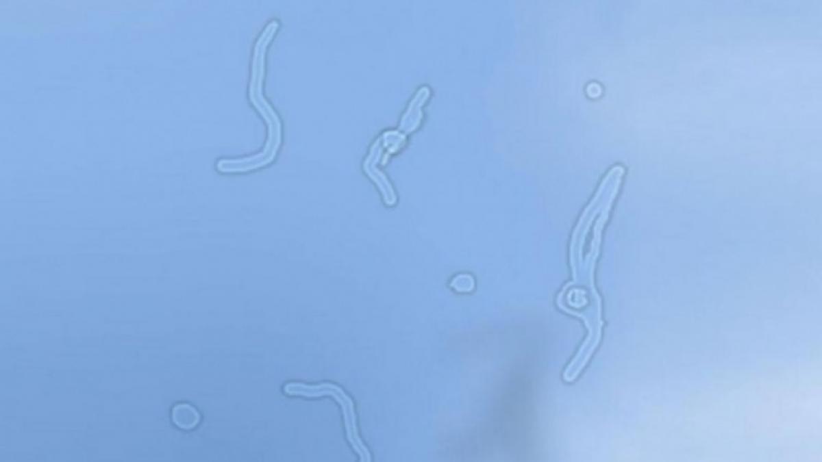 vezi asa ceva in fata ochilor uite ce este in neregula cu tine