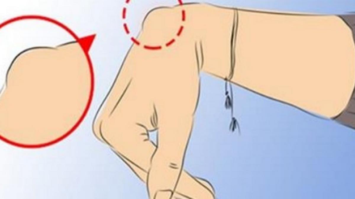 semnul care poate ascunde o afectiune grava tie ti a aparut asa ceva pe mana