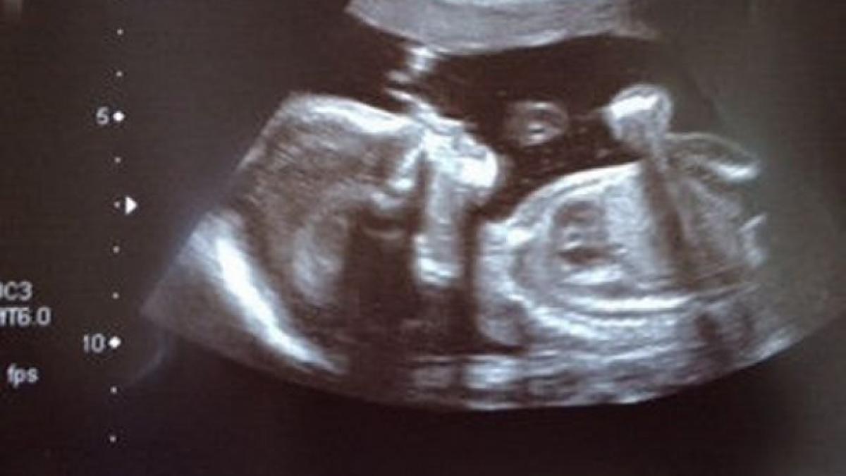 s a nascut normal insa a ajuns sa arate asa la numai patru luni toata lumea este uimita cand o vede