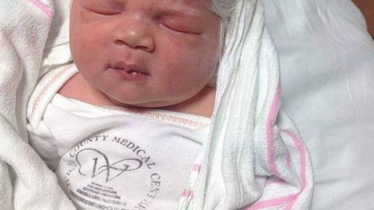 cand i a scos bebelusul din burta si s a uitat la el medicul a ramas socat femeia a cerut sa si