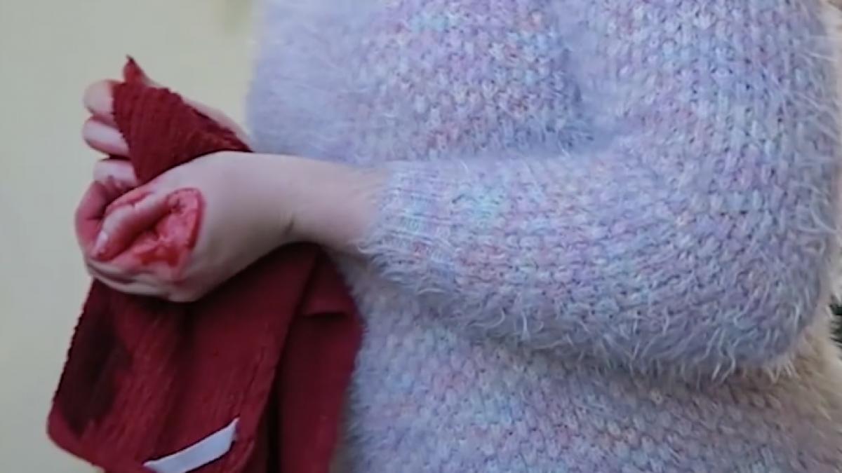 si a chemat de urgenta iubitul acasa pentru ca se taiase grav la mana ce a facut barbatul cand a