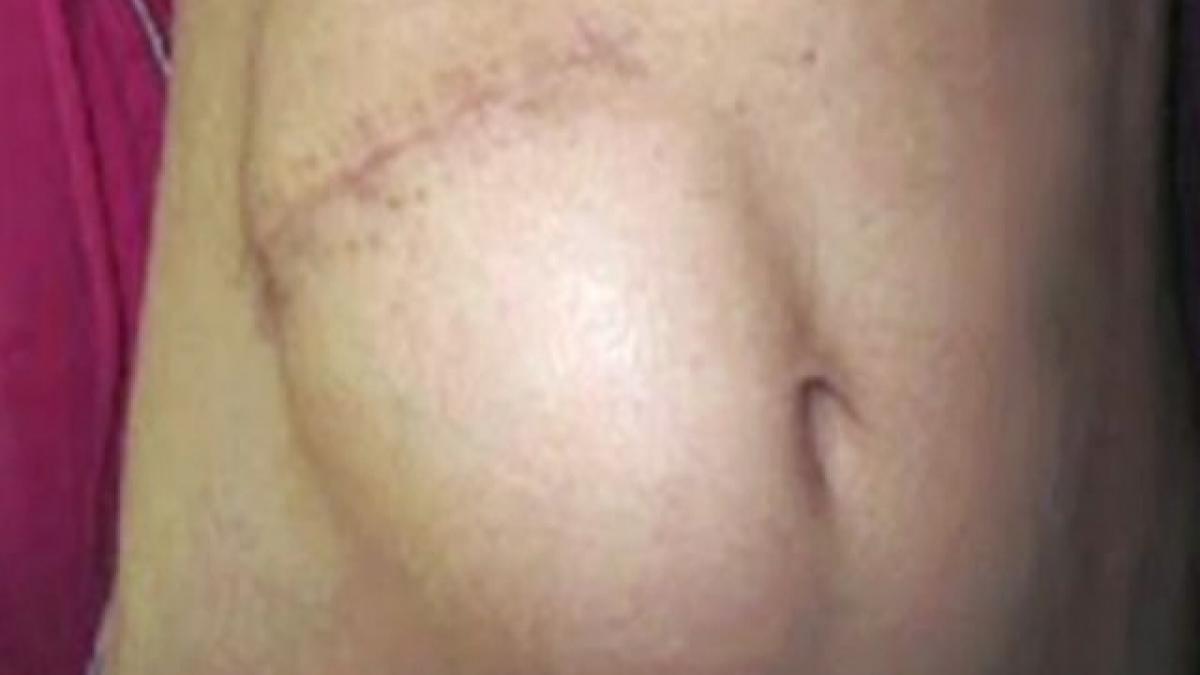 avea dureri de stomac i au deschis abdomenul si au descoperit ceva halucinant doctorii in stare de