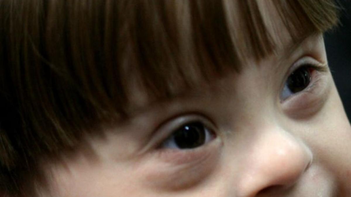 anunt important pentru parintii copiilor cu sindrom down