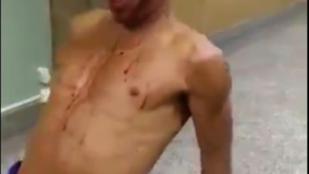 un barbat impuscat in fata a speriat un spital