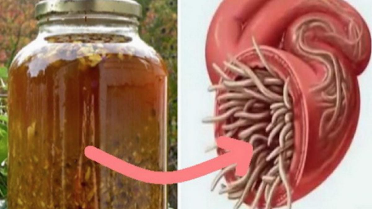 antibioticul natural care vindeca toate infectiile din corp si ucide toti parazitii