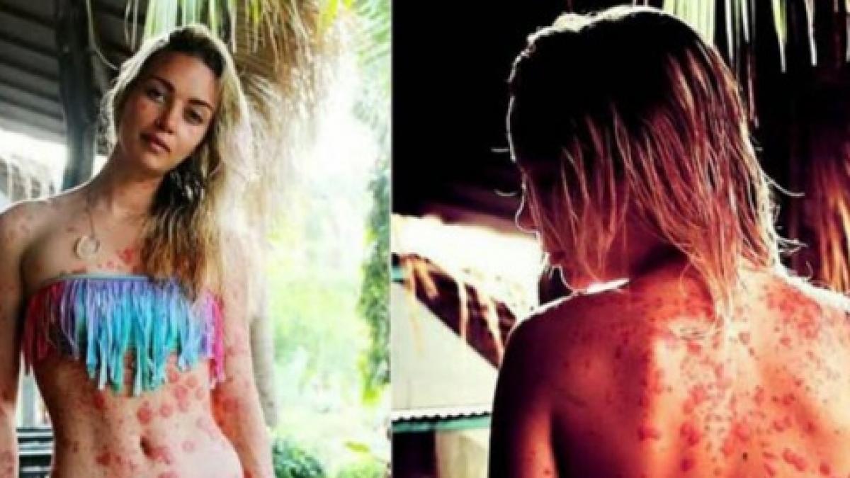 a doua zi dupa ce tatal ei a murit s a trezit cu niste pete rosii pe picioare la inceput nu a facut