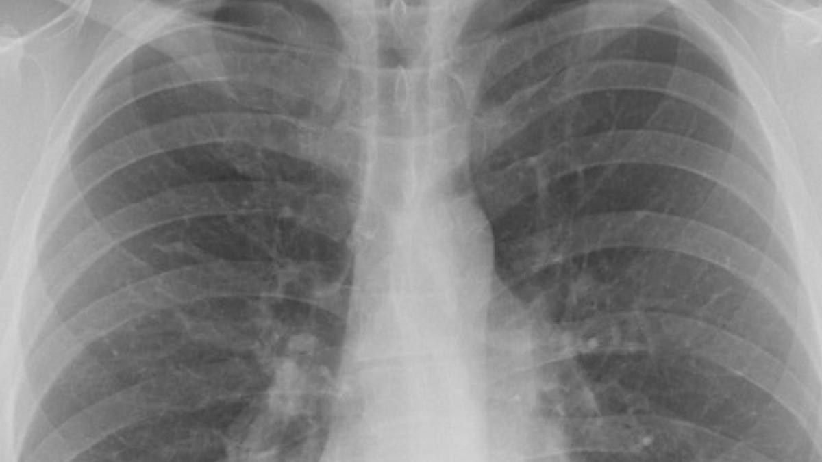 descoperire revolutionara plamanii au inca o functie