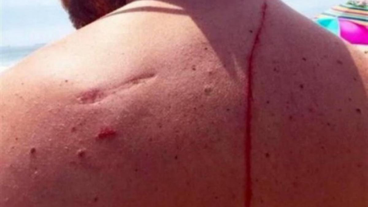 taticule de ce spatele tau este insangerat l a intrebat ingrozit fiul ce a urmat e ireal