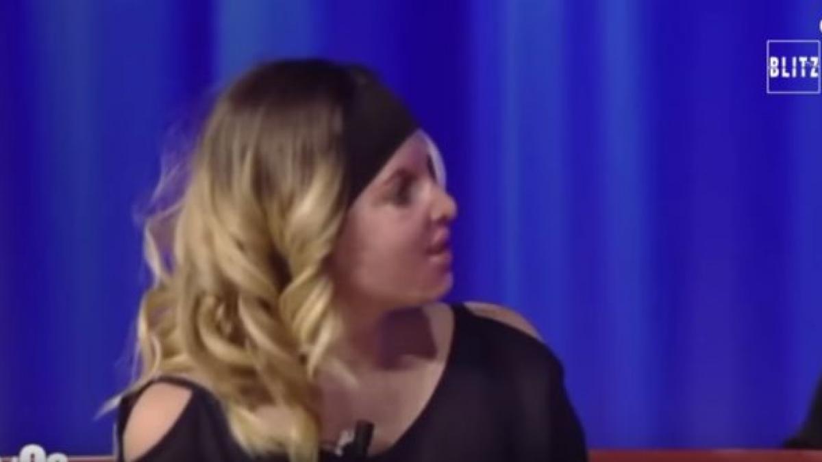 mutilata pe viata fosta miss italia isi arata chipul desfigurat dupa ce a fost stropita pe fata cu