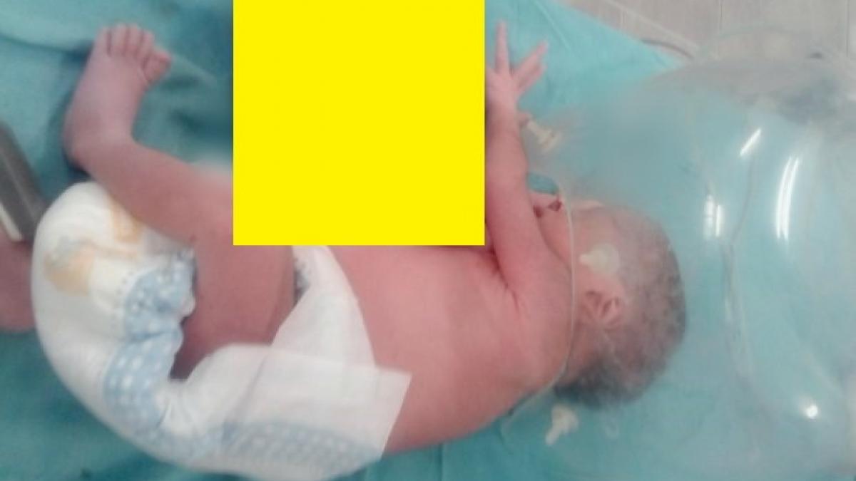 fetita nascuta cu un al doilea cap in zona pieptului salvata dupa o operatie de patru ore