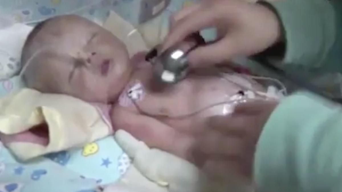 un nou nascut ingropat de viu si a fost salvat in ultima clipa medicii s au ingrozit avea gura