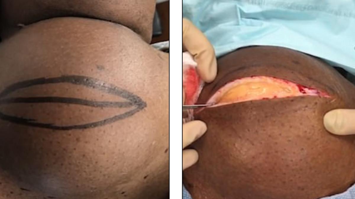 ce reprezinta aceasta imagine ai zice ca este o gravida dar nu