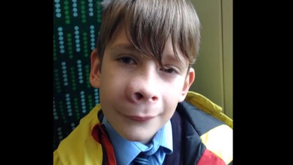 intr o dimineata au observat o umflatura pe nasul fiului lor au crezut ca a fost intepat de o