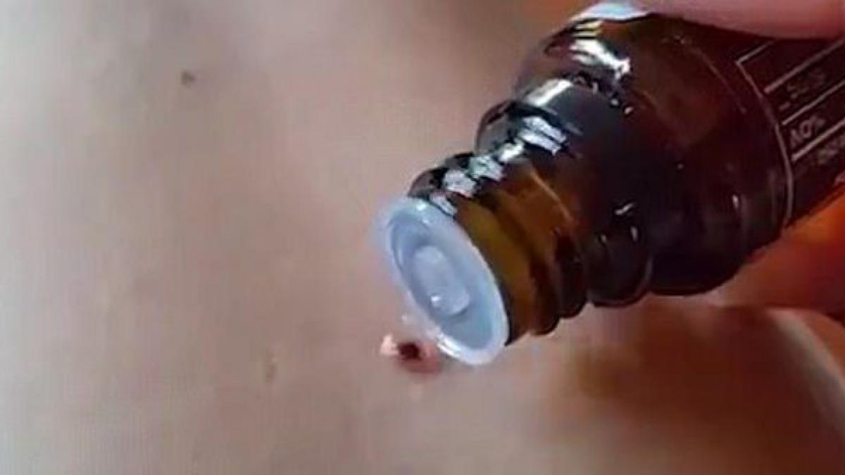 o femeie indeparteaza o capusa cu ulei de menta este cea mai mare greseala