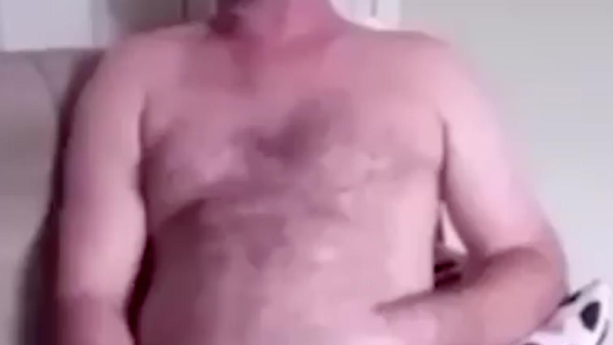 cum a ajuns acest barbat cu mana cusuta in stomac imagini uluitoare