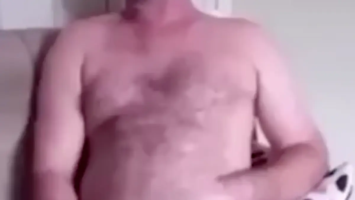cum a ajuns acest barbat cu mana cusuta in stomac imagini uluitoare