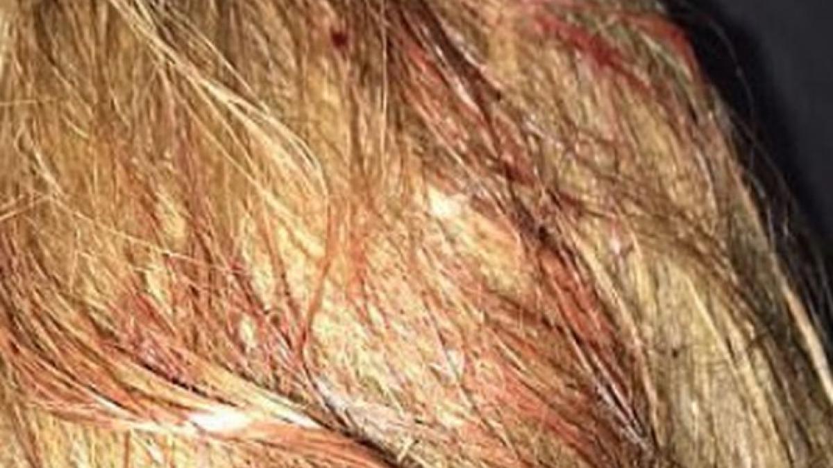 martor al exploziei de la manchester arena brusc am inceput sa vedem pe jos piele jupuita inca mai