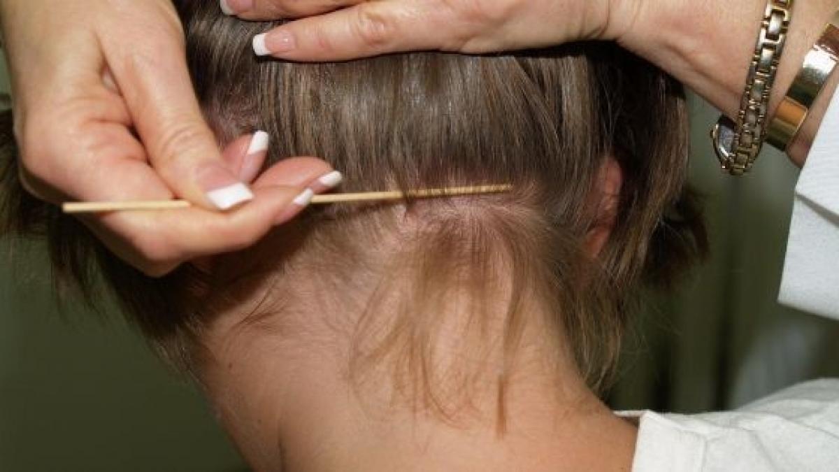 adevaratul motiv pentru care apar paduchii nu are nicio legatura cu igiena