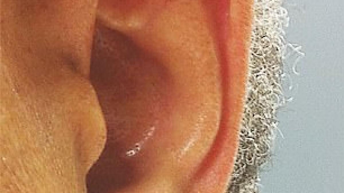 ai semnul acesta pe lobul urechii trebuie sa vezi imediat un medic viata ta depinde de asta