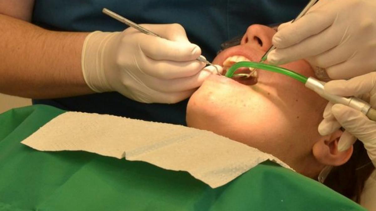 acuzatii grave pentru un dentist din rusia o pacienta a ramas fara dinti desi nu avea nicio carie