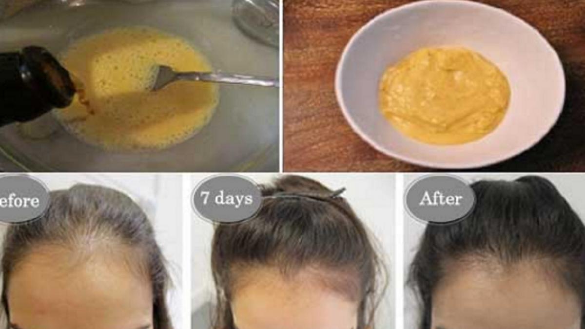 aceasta este masca miraculoasa care iti face parul sa creasca intr o saptamana ai nevoie de doua