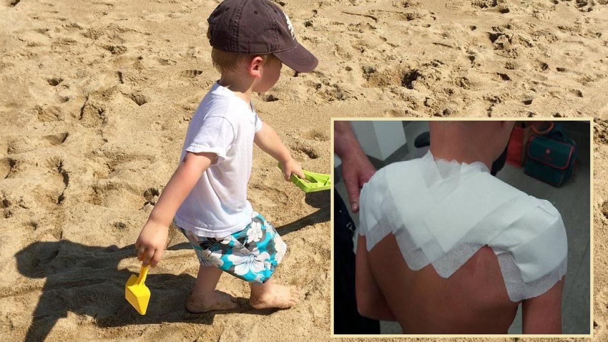 socul unei mame dupa ce si a dat copiii cu acest fel de lotiune de plaja arata ca sunca prajita