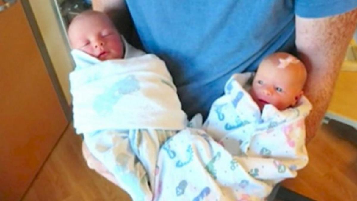 a nascut gemeni perfecti intr o zi blestemata doctorii au descoperit o diferenta infioratoare