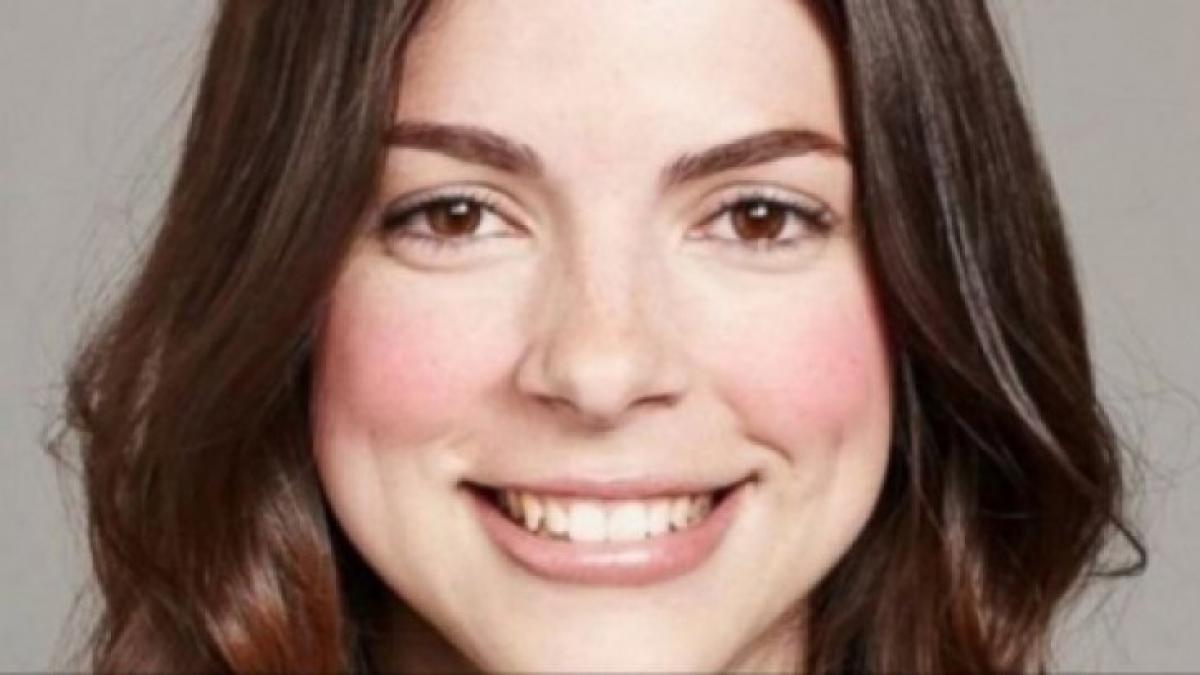 s a dus la plaja dar a uitat sa se dea cu crema pe fata este cumplit ce i s a intamplat dupa trei