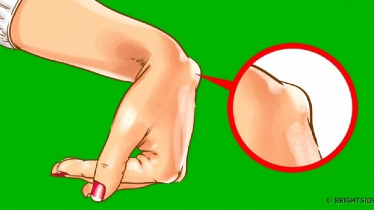 verb Is Awareness Ți-a apărut o umflatură pe încheietura mâinii? De ce trebuie să mergi  neapărat la medic!