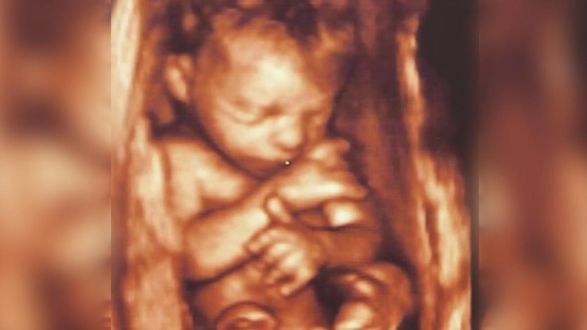 mama insarcinata a vrut sa filmeze prima ei ecografie dar cand medicul a vazut ce are in ea i a