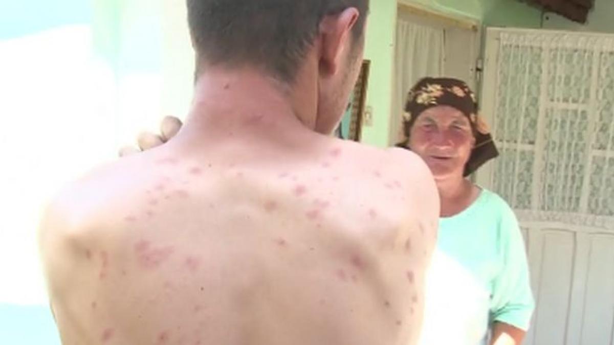 albinele terorizeaza judetul iasi mai multi oameni au ajuns la spital