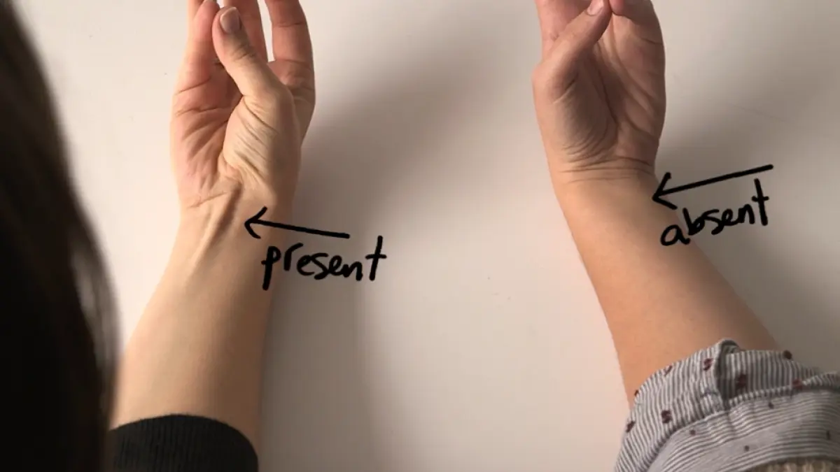 dovezile evolutiei sunt chiar in corpul tau de ce la unii oameni acest tendon nu este vizibil