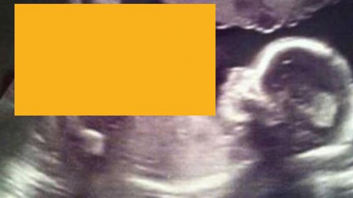 o mamica i a aratat unei prietene ecografia fetitei sale detaliul pe care l a observat a facut o sa