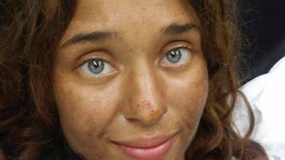 o tanara de 25 de ani a supravietuit timp de o luna in salbaticie cum a fost gasita