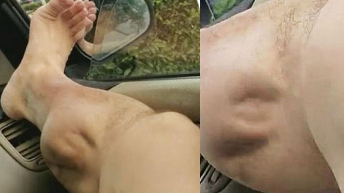 tocmai iesise de la sala de forta cand a simtit o durere puternica s a uitat la piciorul sau si nu