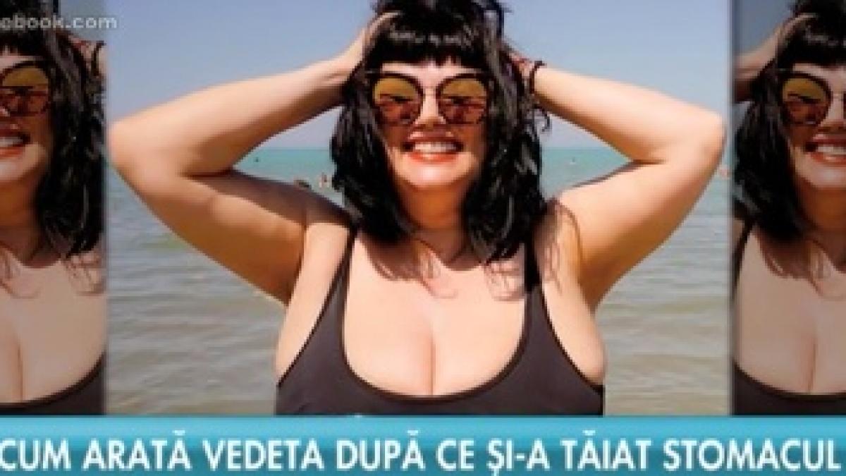 primele imagini cu ozana barabancea in costum de baie dupa operatia prin care si a micsorat stomacul