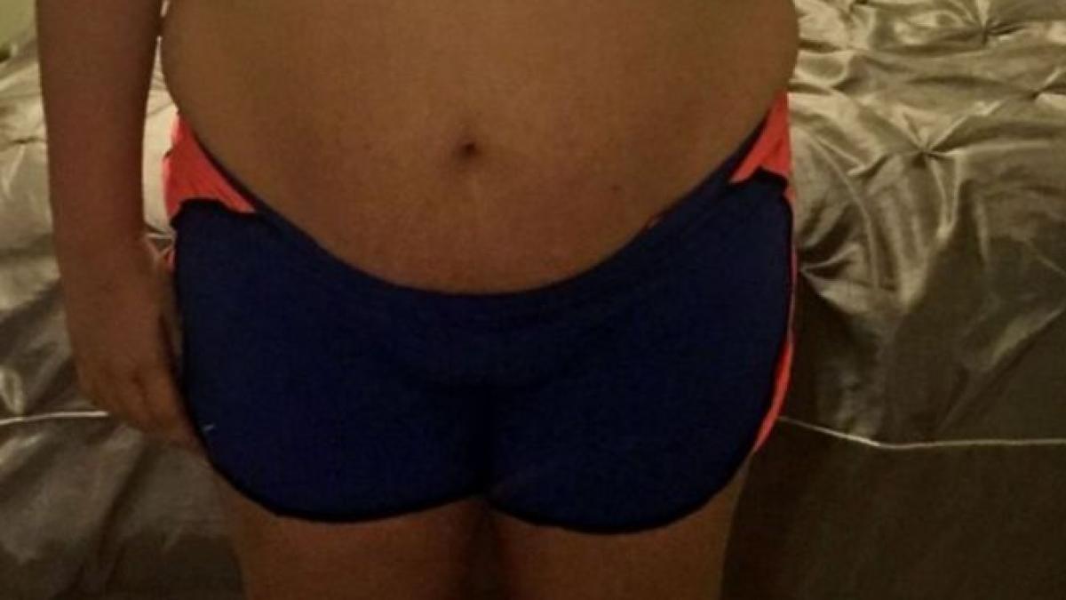 si au dus fiica la medic crezand ca sufera de obezitate dar a primit o veste cumplita ce s a gasit