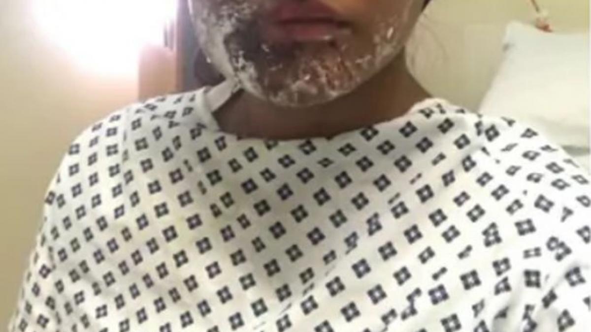 a fost atacata cu acid si desfigurata in ziua in care implinea 21 de ani medicii au facut o minune