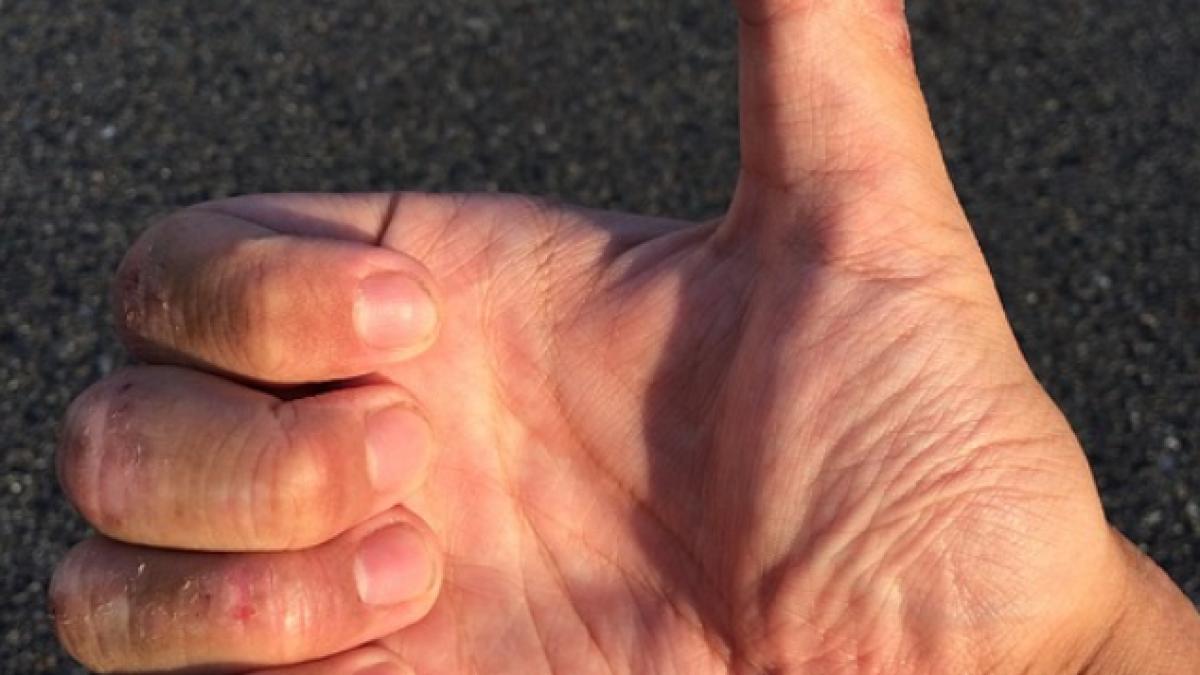 acest barbat si a ros unghiile la scurt timp dupa aceea era mort este de necrezut ce i s a intamplat